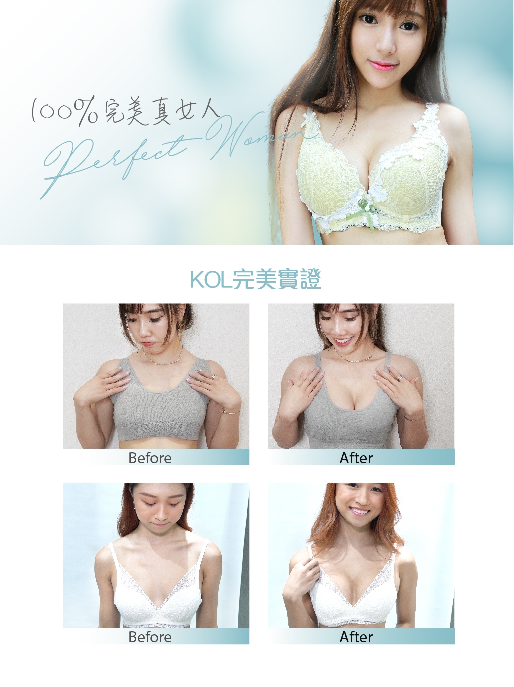 3D Bust Medicare®豐胸術橫幅與前後對照