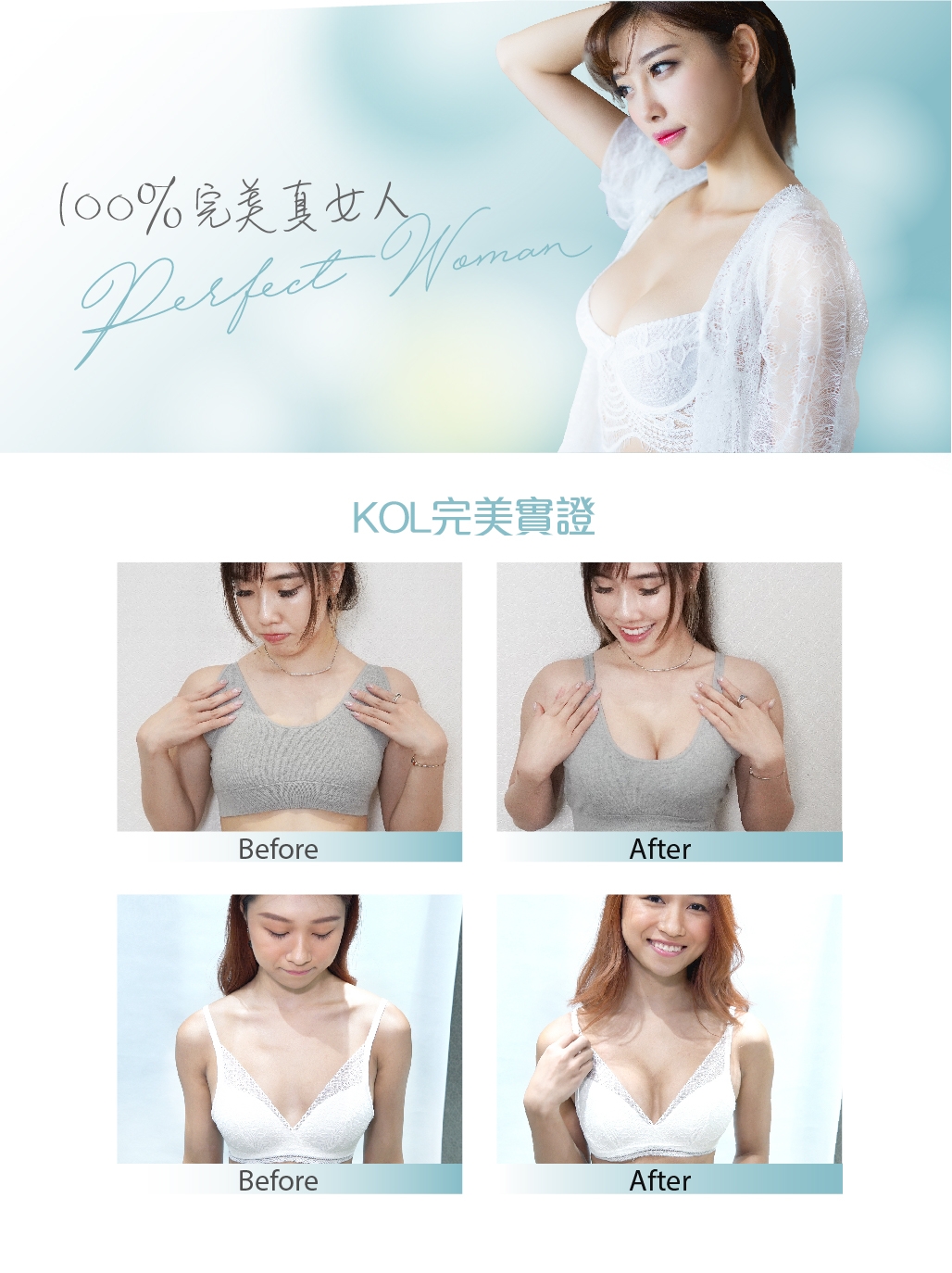 日本TI皮洛乳腺淋巴豐胸術橫幅與前後對照